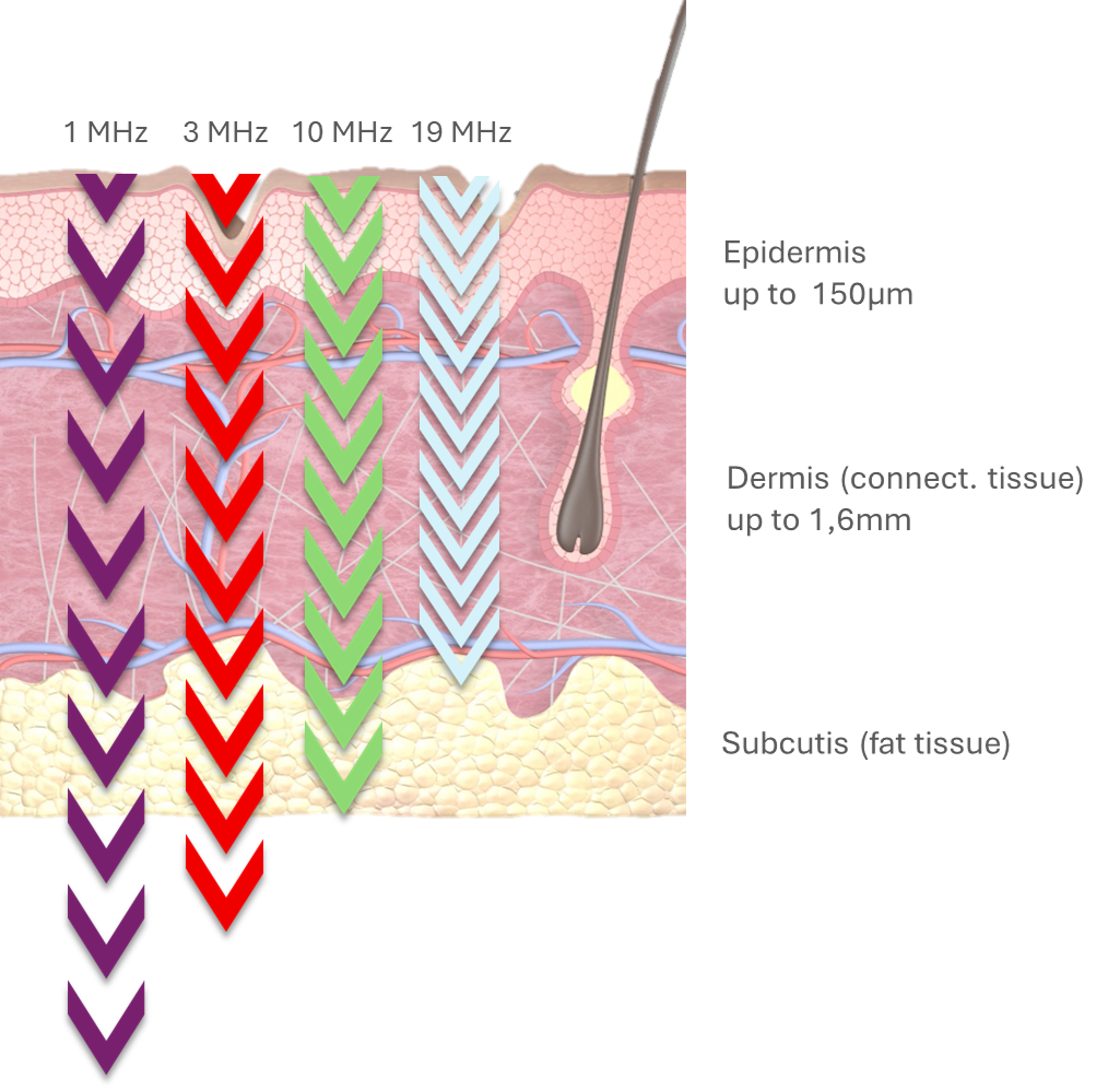 Eindringtiefen_engl_Neu Eindringtiefen_engl_Neu