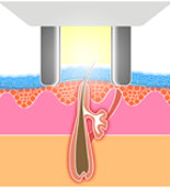 Elos Illustration1 Bild Elos Illustration1