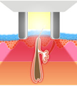 Elos Illustration 2 Bild Elos Illustration 2