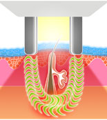 Elos Illustration 3 Bild Elos Illustration 3